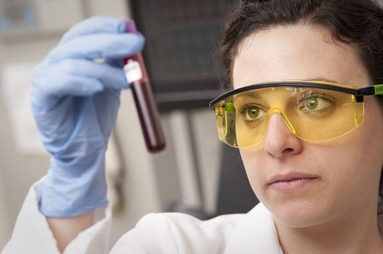 Biological Age Blood Tests Face Validation Reckoning A blood sample in a laboratory